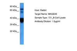 MAGEA6 Rabbit anti-Human, Polyclonal, Novus Biologicals 0.1ml; Unconjugated:Antibodies,